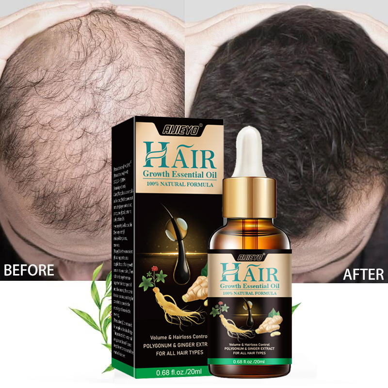 Aceite de biotina 2023 para el - Epidermal Growth Factor reseña y precio