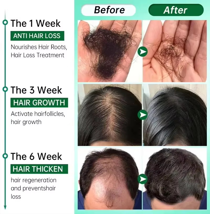 Suero para el crecimiento del  - Epidermal Growth Factor reseña y precio