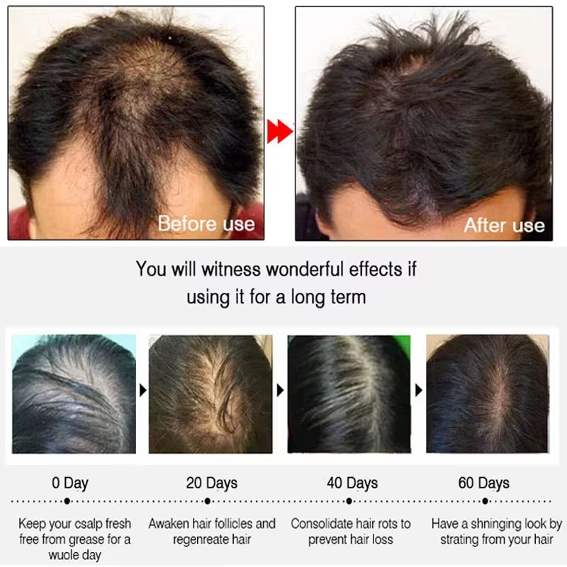 Spray de Crecimiento Rápido de - Epidermal Growth Factor reseña y precio